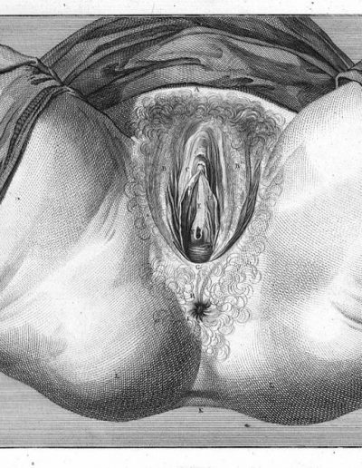 1757 Smellie Clitoris